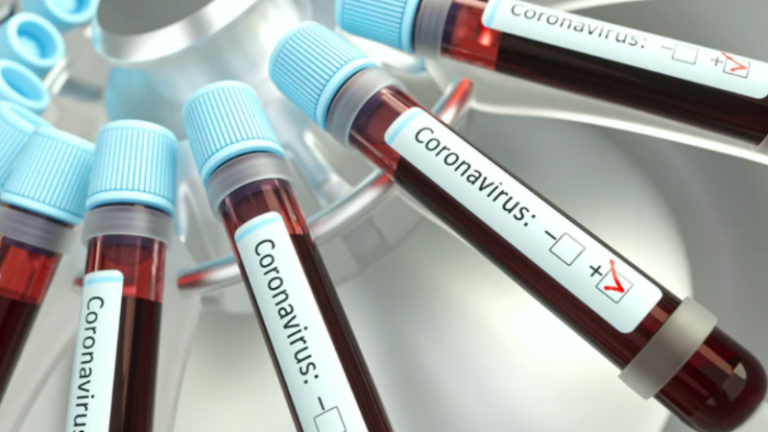 Sulme kibernetike ndaj kompanive që prodhojnë vaksinën anti-covid