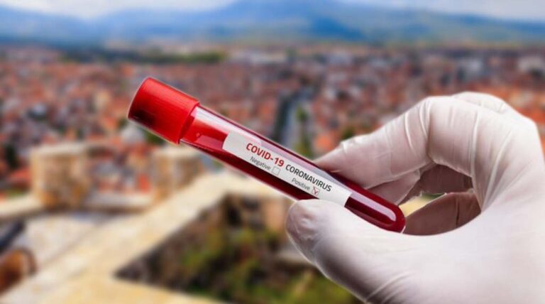 337 raste me Covid-19 në Kosovë, me nga 4 raste komunat: Prizren, Rahovec, Malishevë