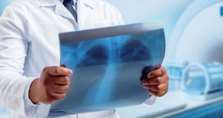 Mjeku kosovar jep lajmin e mirë: Covid-19 nuk lë pasoja në sistemin respirator!