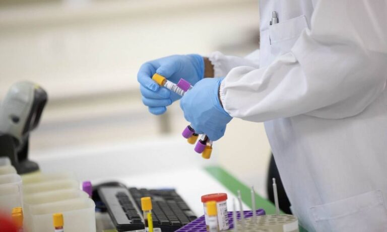 6 raste pozitive me Covid-19 sot në Kosovë