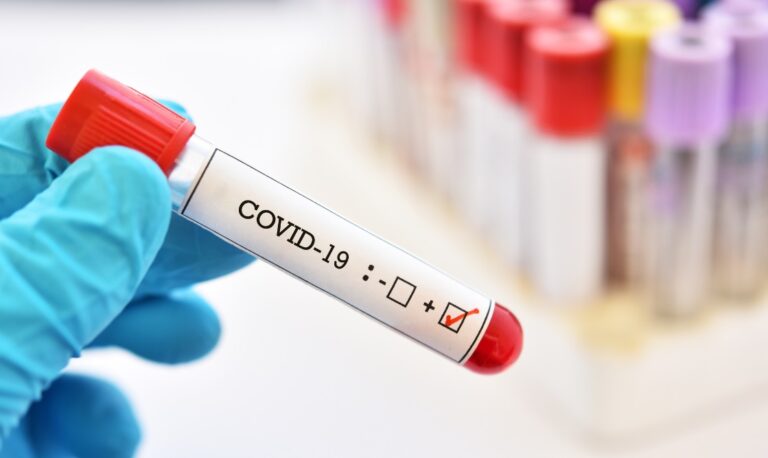 10 mijë e 885 raste aktive me koronavirus në vend