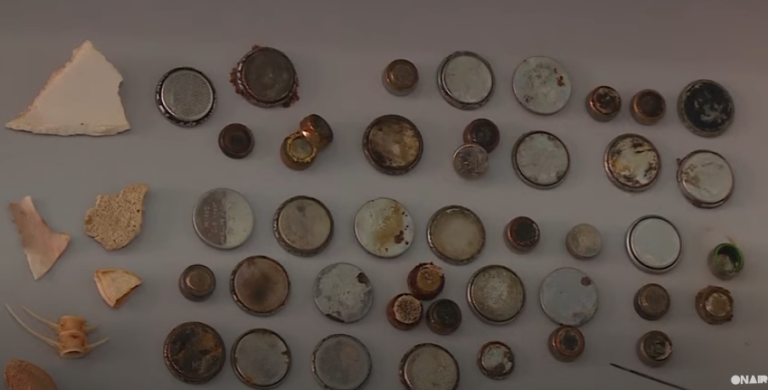 Mjekët mbledhin sende të rrezikshme që i gëlltitën fëmijët (VIDEO)