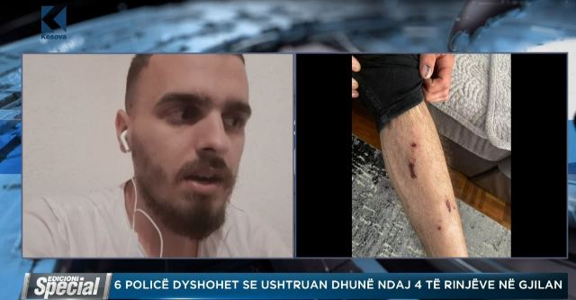 Gjilanë: Policët i fikën dritat, na rrahën në terr (Video)
