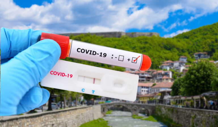 28 raste të reja me koronavirus në Kosovë, 2 në Prizren