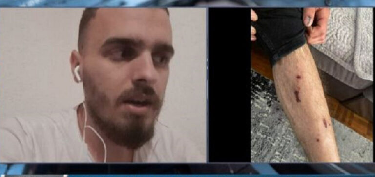 IPK rekomandon suspendimin e katër policëve që dyshohet se rrahën disa të rinj