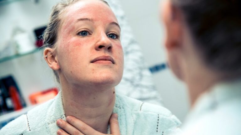 Këshilla e dermatologut: Perimet e gjelbra lehtësojnë inflamacionin dhe skuqjen në fytyrë