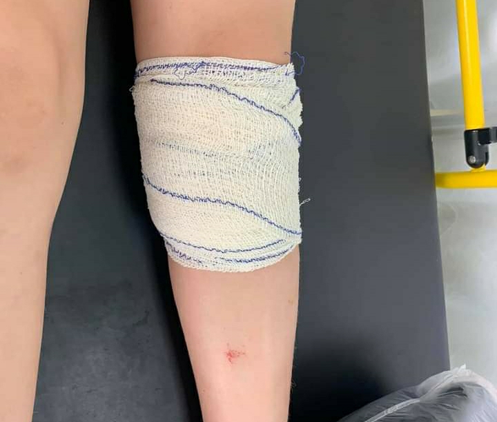 Kosovë: Problem me qentë endacakë, sot e pësoi edhe djali i deputetes kosovare