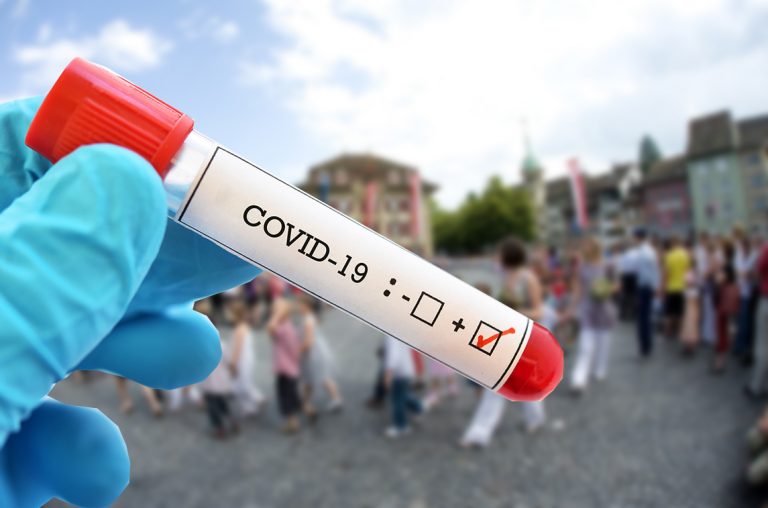 356 raste pozitive në Kosovë në 24 orë