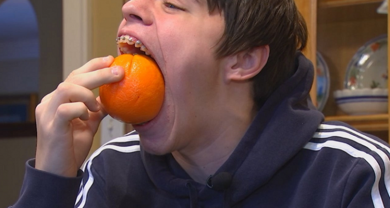 14-vjeçari fiton për herë të dytë rekordin Guinness për gojën më të madhe (Video)