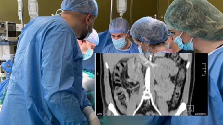 Mjekët në QKUK realizojnë për herë të parë operacionin shumë të ndërlikuar të bypass-it vaskular