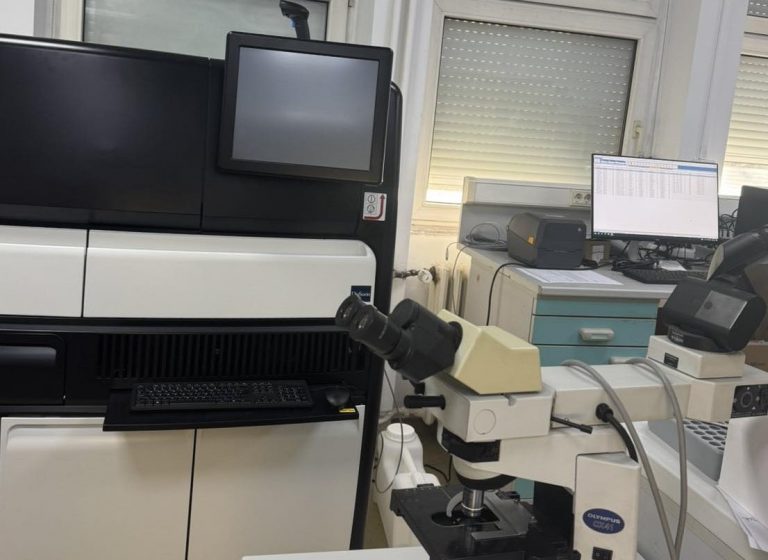 IKShPK fillon testimin e avancuar laboratorik për zbulimin e turbekolozit